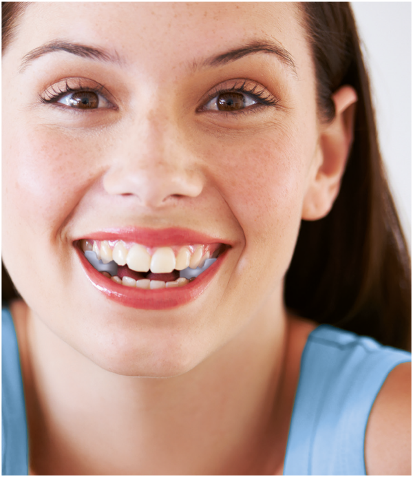 TJ-Motion Aligner Gr. B 5,5