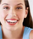 TJ-Motion Aligner Gr. B 5,5